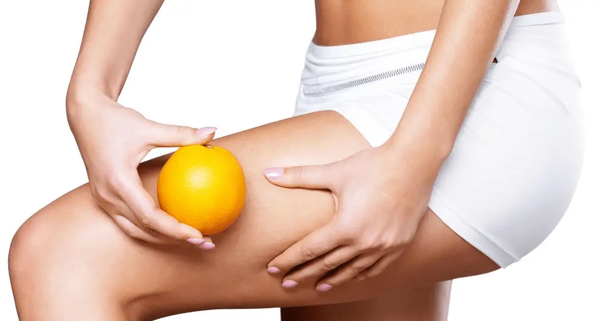 cremas anticelulíticas